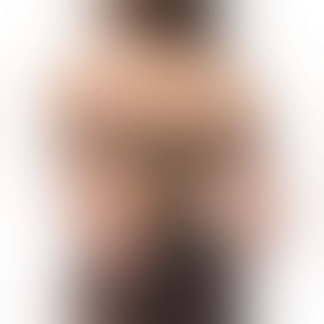 Фіксатор Bedroom Fantasies Blissfully Bound Arm Restraint Set - Black