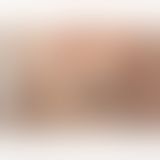 Пестіси - Pasties Burlesque Rand Golden