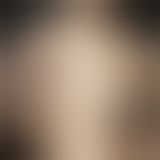 Пестіси - Reusable Spider Glittering Nipple Pasties