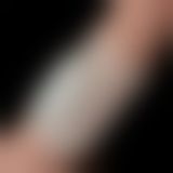 Насадка на член - Vibrating Ridge Knights Ring White