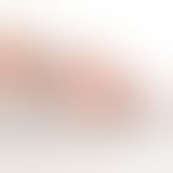 Вібратор на палець Otouch Yu, 7 режимів, водостійкий